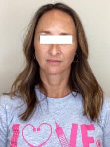 After Image: Toxins