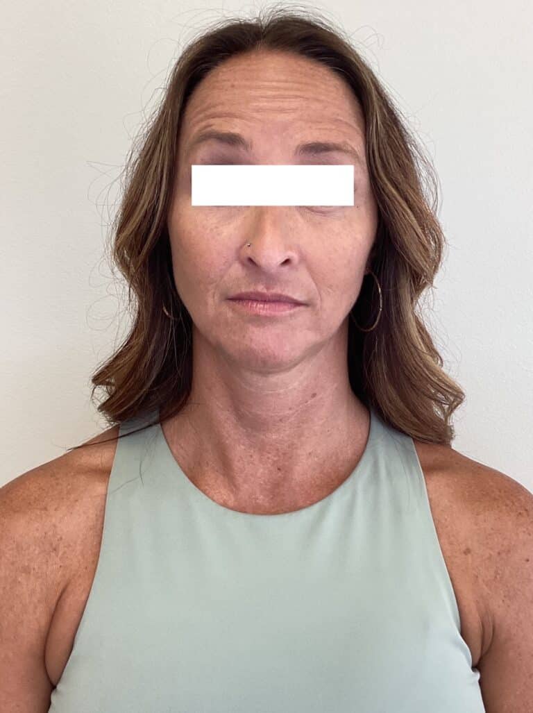 Before Image: Toxins - front