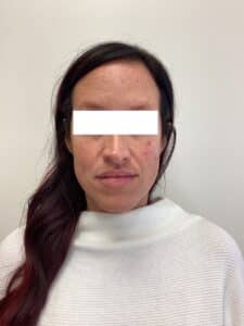 Before Image: BBL