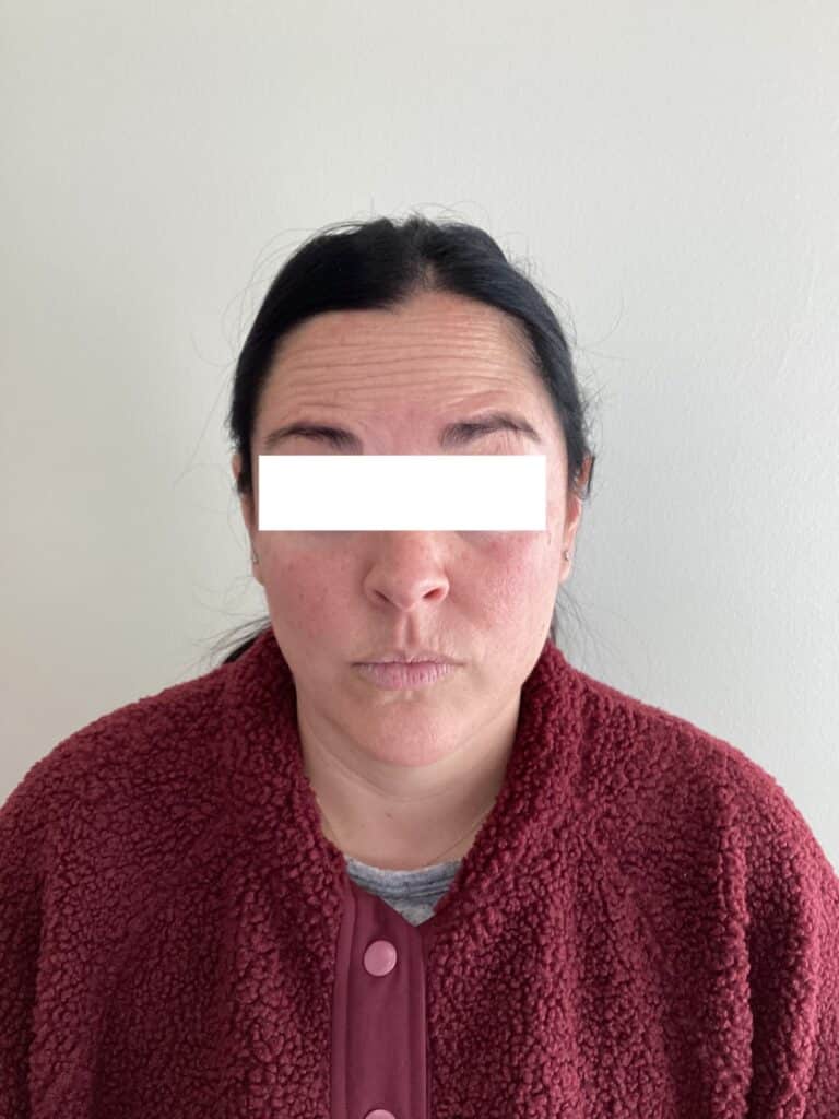 Before Image: Toxins - front